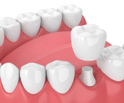 General Dentistry